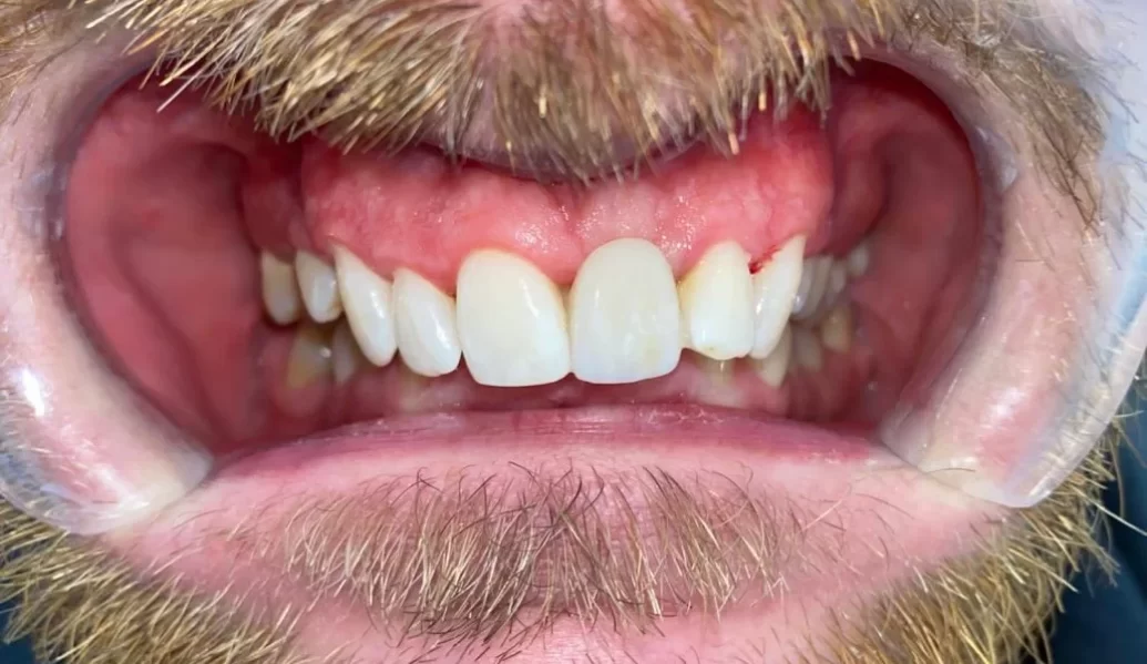 After - Knighton Dental