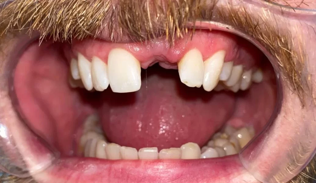 Before - Knighton Dental