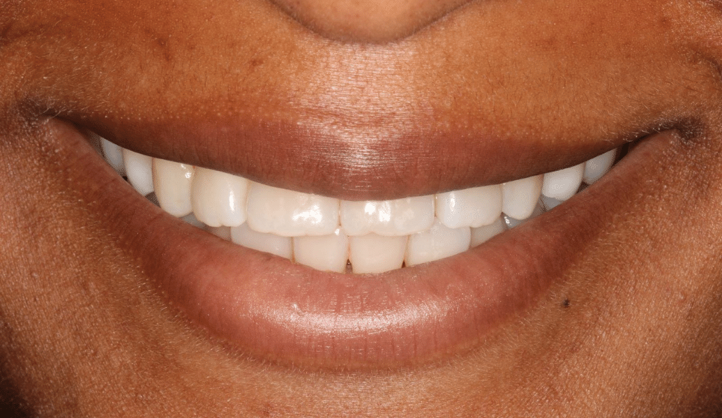 Before - Knighton Dental