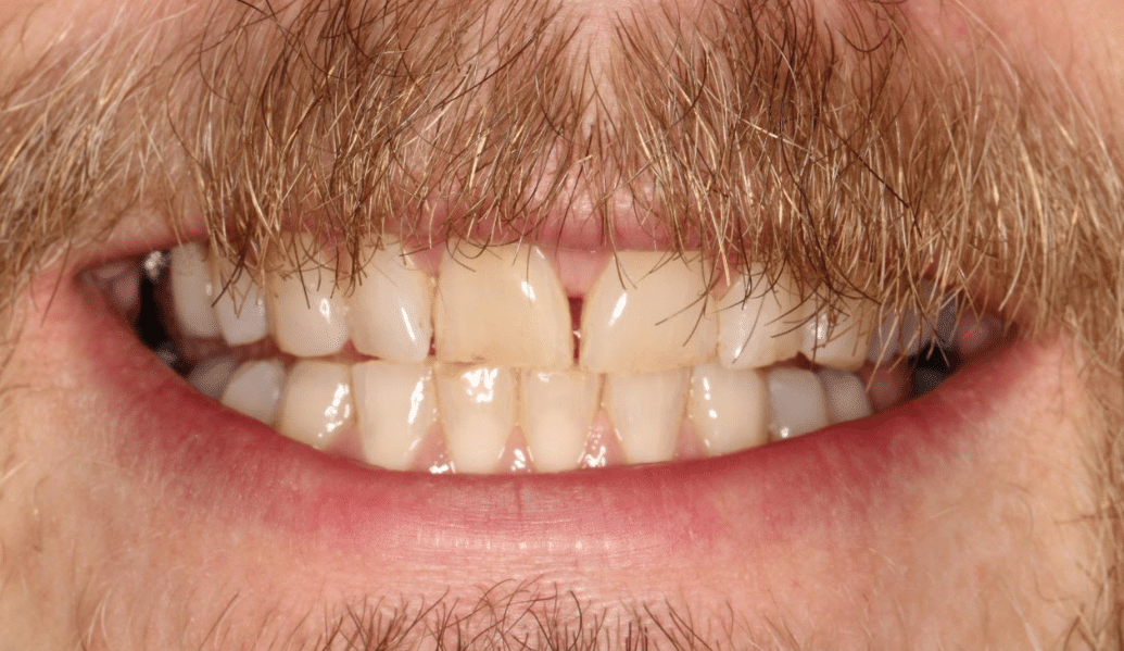 Before - Knighton Dental