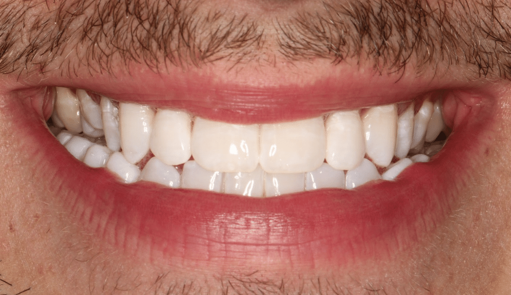 After - Knighton Dental