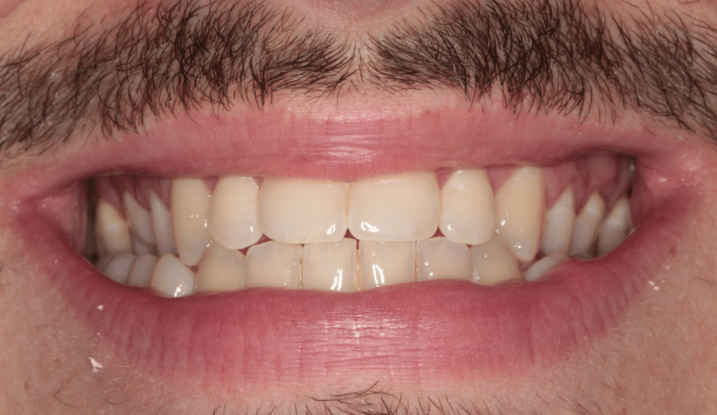 Before - Knighton Dental