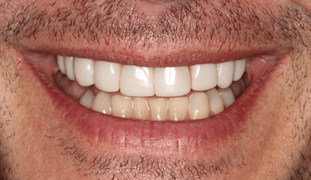 After - Knighton Dental