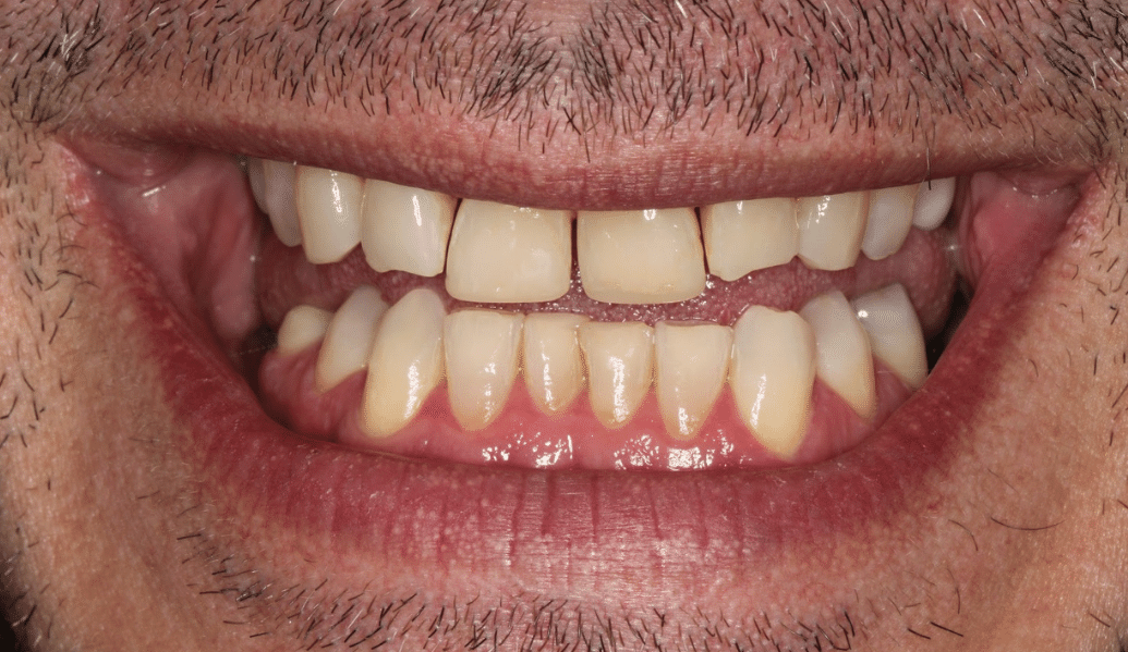 Before - Knighton Dental