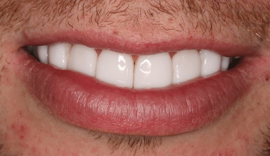 After - Knighton Dental