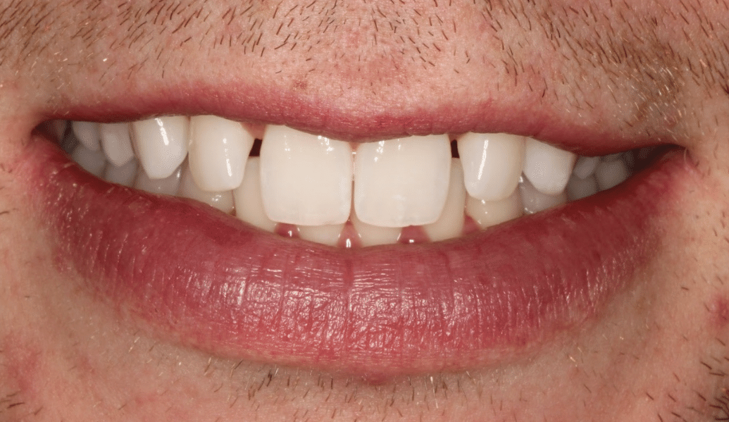 Before - Knighton Dental