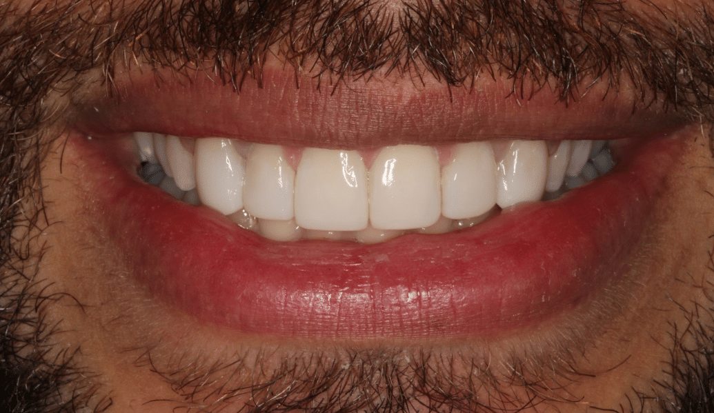 After - Knighton Dental