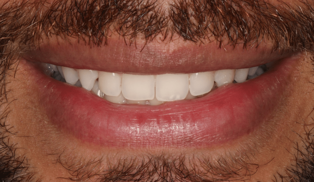 Before - Knighton Dental