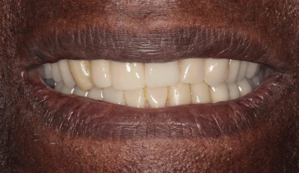 After - Knighton Dental