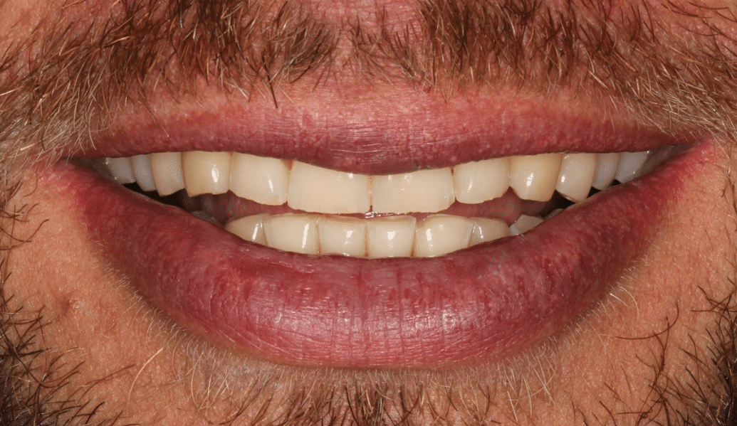 Before - Knighton Dental