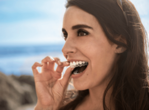 Invisalign Leicester