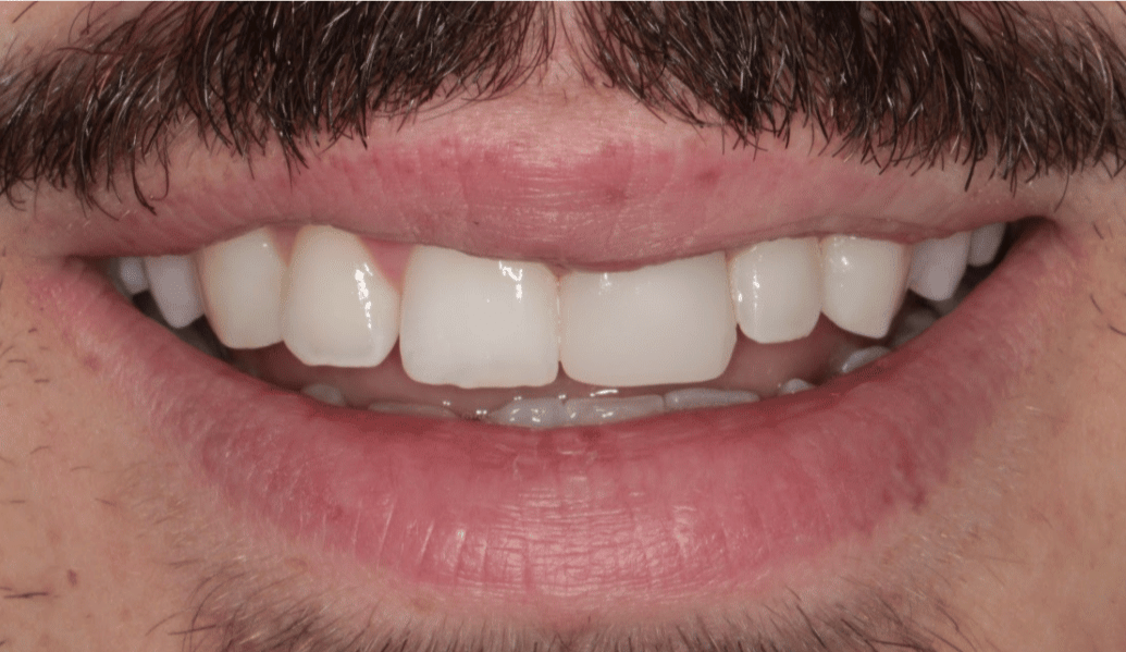 After - Knighton Dental