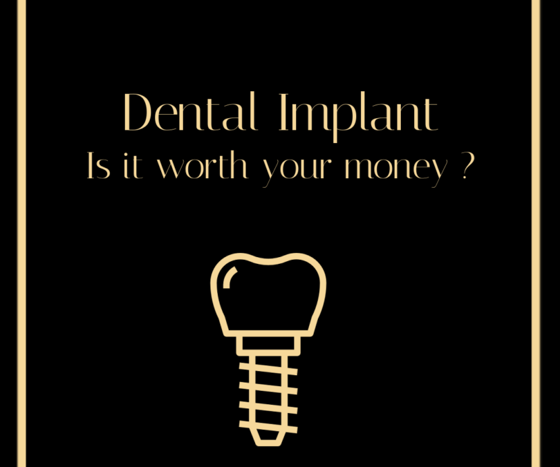 Best dental implants Leicester