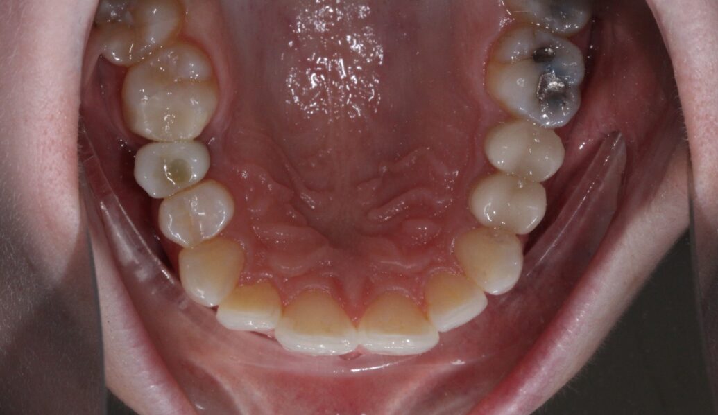 After - Knighton Dental