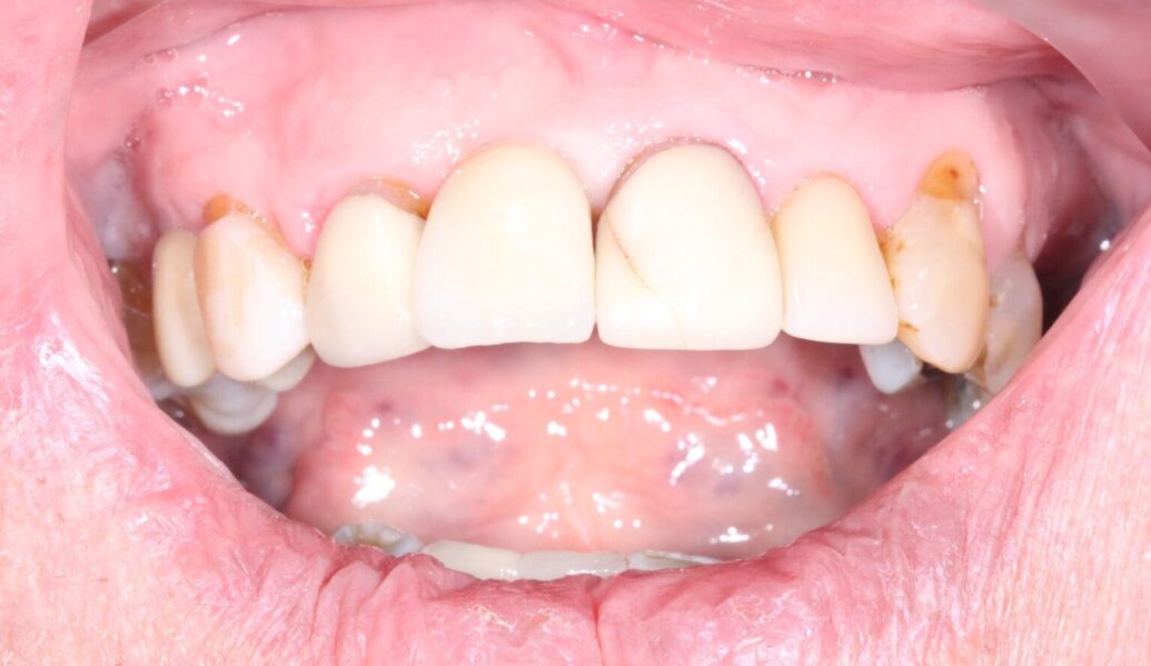 After - Knighton Dental
