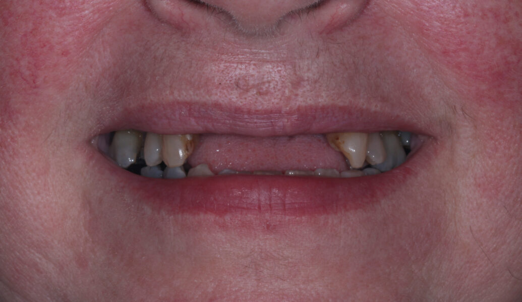 Before - Knighton Dental