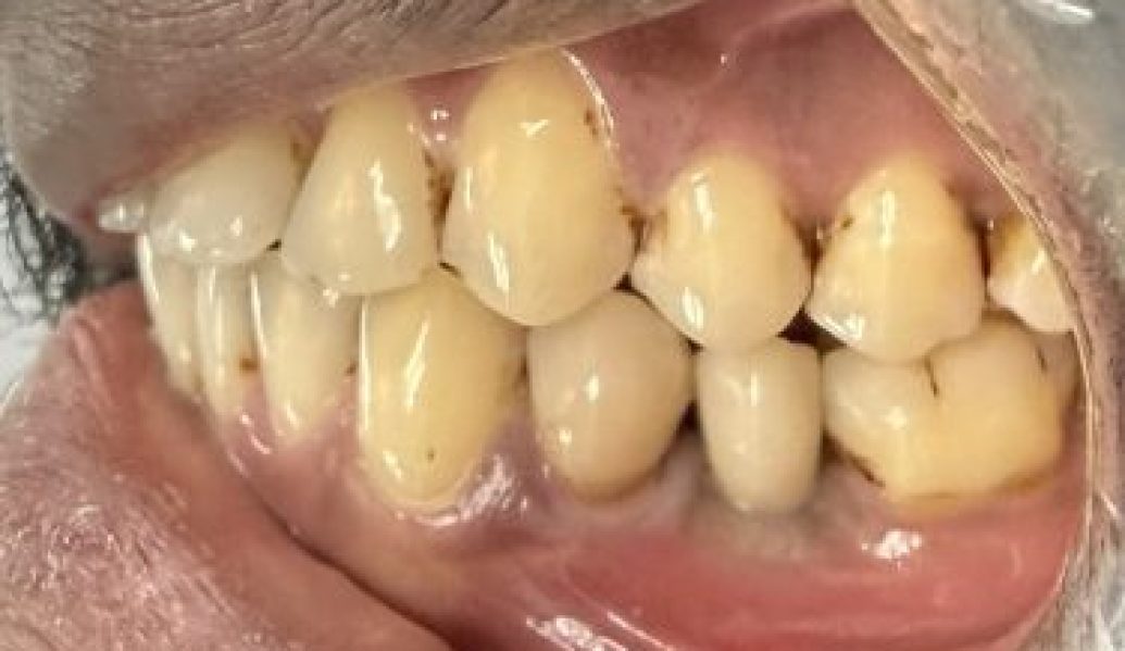 After - Knighton Dental